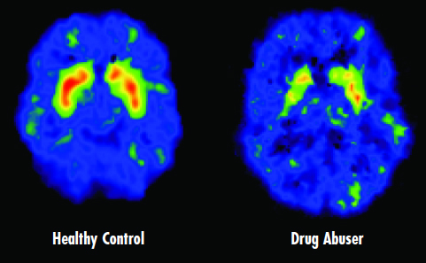 common-misconception-drugs-brain-2