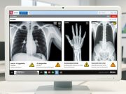 Вештачката интелигенција прави рендгенски снимки што и радиолозите тешко ги разликуваат од вистинските