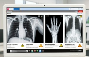 Вештачката интелигенција прави рендгенски снимки што и радиолозите тешко ги разликуваат од вистинските