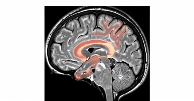 zgolemen-striatum-psihopatski-crti